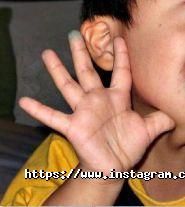 Суваг, міський медичний центр проблем слуху та мовлення фото