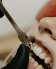 Dent-House, стоматологія фото