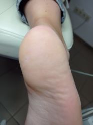 Медичний педикюр, подолог Афанаскіна Жанна фото