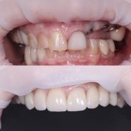 DS, стоматологія фото