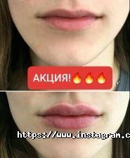 Ательє краси, центр естетики фото