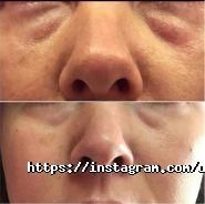 Bianko, кабінет косметології фото