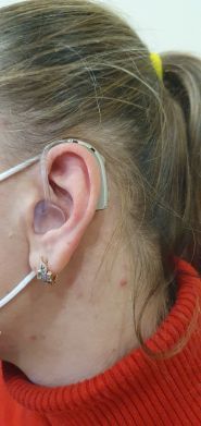 Слух топ, центр реабілітації слуху фото