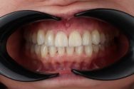Denta vi, стоматологічна клініка фото