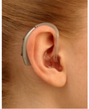 Смела-Аудио, магазин слуховых аппаратов фото
