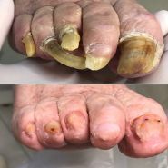 Подолог Здорова Стопа, клініка фото