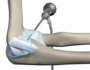 Центр ендопротезування та артрології, медична клініка фото