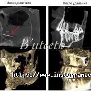 B’uteeth, стоматологічна клініка фото