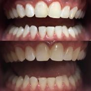 Зубна Фея, центр ортодонтії фото