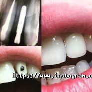 Аюдент, стоматологія фото