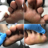 Podolog Family, врач подолог фото