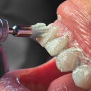 Yeremchuk Dental, стоматология фото