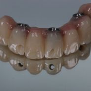 Приватна стоматологія лікаря Прокопенка фото