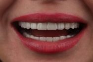 Denta vi, стоматологічна клініка фото