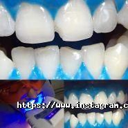 Аюдент, стоматологія фото