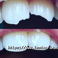 Аюдент, стоматологія фото