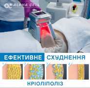 Alpha Cell, центр регенеративної медицини Alpha Cell, центр регенеративної медицини фото