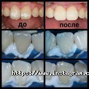 B’uteeth, стоматологічна клініка фото