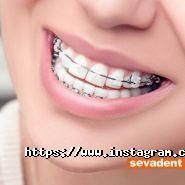 Sevadent Dental Clinic, стоматологічний центр фото