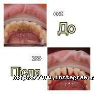 32 перлини, стоматологія фото