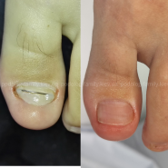 Podolog Family, врач подолог фото