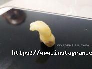 ViVaDent, Стоматологія фото