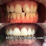 LizaDent, стоматологія фото