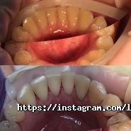 LizaDent, стоматологія фото