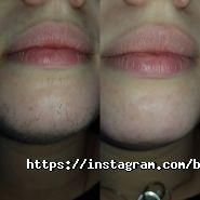 Кабинет депиляции на Московський фото