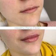 Healthy Face Clinic, клініка здорової краси фото