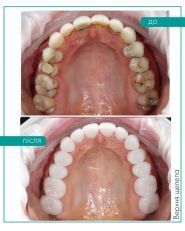 SP dent, стоматологічна клініка фото