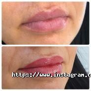 Permanent-Style Ukraine, школа-студія перманентного макіяжу фото