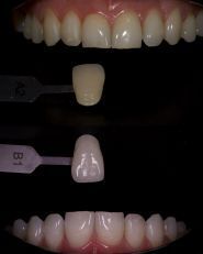 Dental Spa Clinic, стоматологія фото