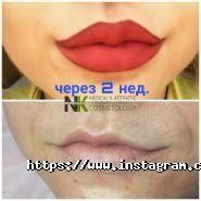 Кабінет медичної та естетичної косметології Наталії Капійчук фото