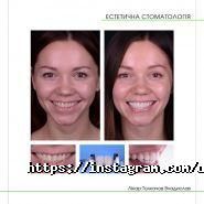 Дарлін, стоматологія фото