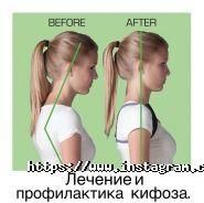 Південноукраїнський центр відновлення хребта фото