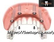 Platon, стоматологічний центр фото