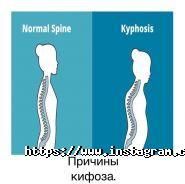 Південноукраїнський центр відновлення хребта фото