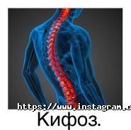 Південноукраїнський центр відновлення хребта фото