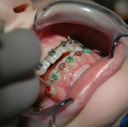 Dent Aestetik, стоматологія фото