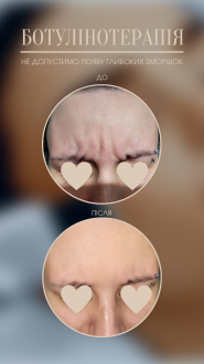 Ляшевська Анна, косметолог фото