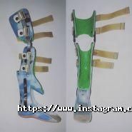 Антисеп-Орто, протезно-ортопедична майстерня фото