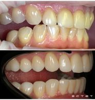 Естет-Дент, стоматологія фото