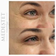 МедЭстет, центр лазерной эпиляции и современной косметологии фото