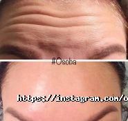 Особа, центр эстетики фото