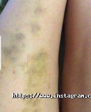 Sugar beauty studio, студія шугаринга фото