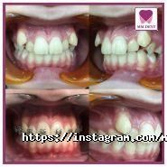 MM Dent фото