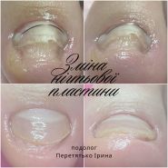 Foot Control, центр нігтьової естетики та подології фото