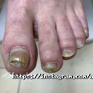 Подологічна практика Соломинської Анни фото