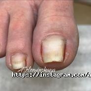 Подологічна практика Соломинської Анни фото